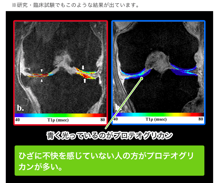 軟骨成分の分解を抑え、関節軟骨の保護に役立ち、ひざ関 節の曲げ伸ばしをサポート